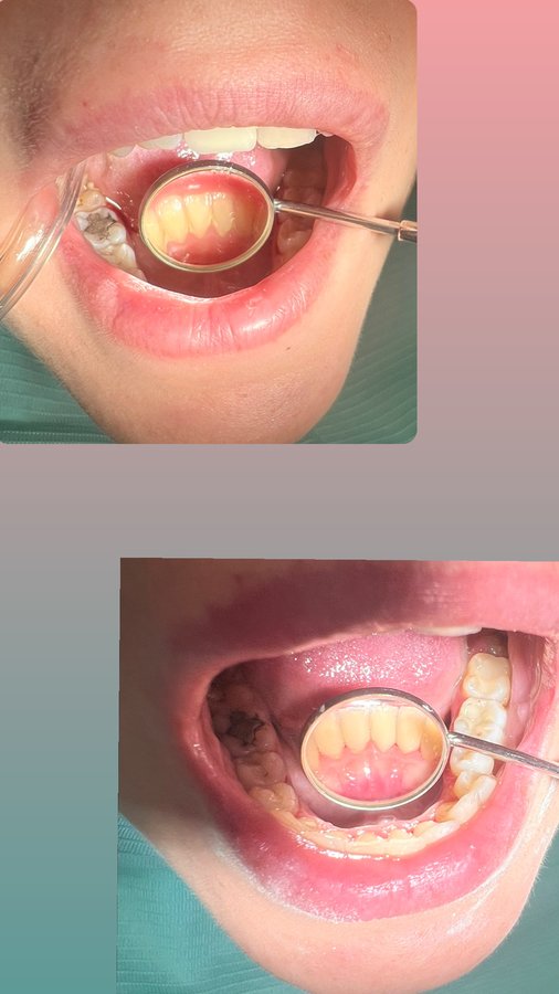 تونا لطب الأسنان - Tona Dental