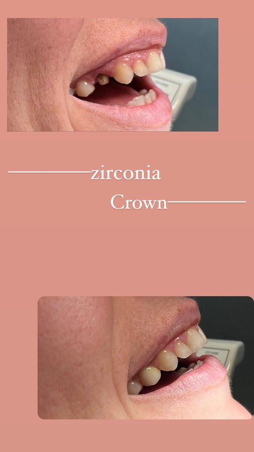 تونا لطب الأسنان - Tona Dental