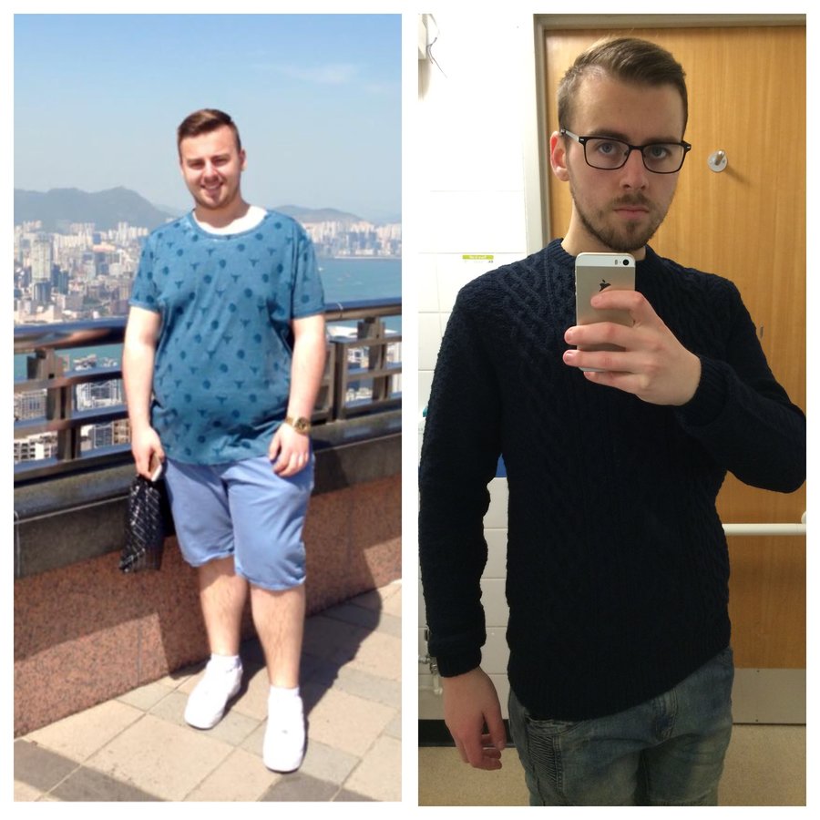 Tonic Weight Loss Surgery Birmingham - Tonic Weight Loss Surgery Birmingham