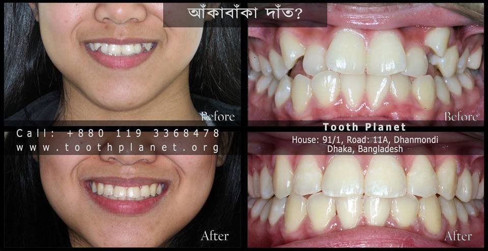 Tooth Planet - Tooth Planet