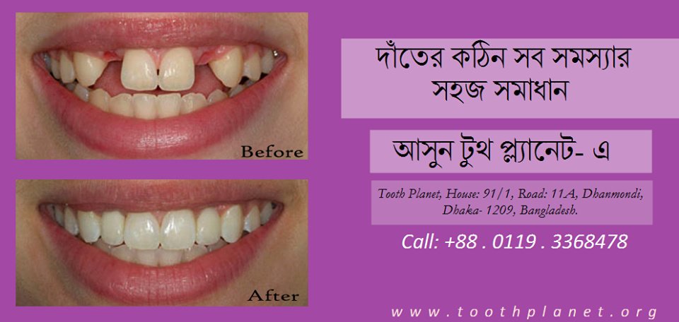 Tooth Planet - Tooth Planet