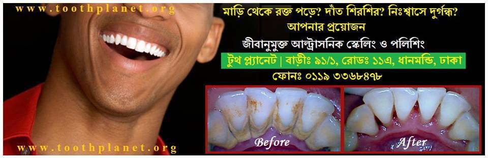 Tooth Planet - Tooth Planet