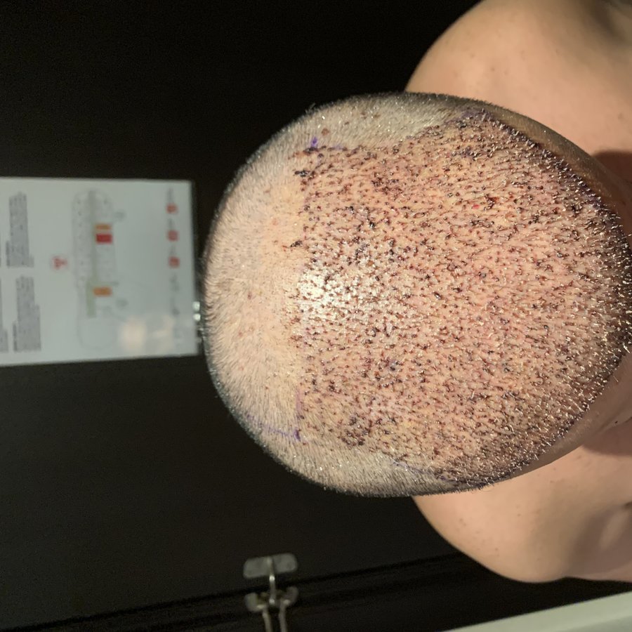 Top Clinic Turkey - Top Clinic Turkey