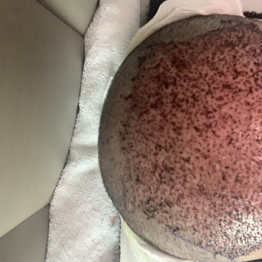 Top Clinic Turkey - Top Clinic Turkey