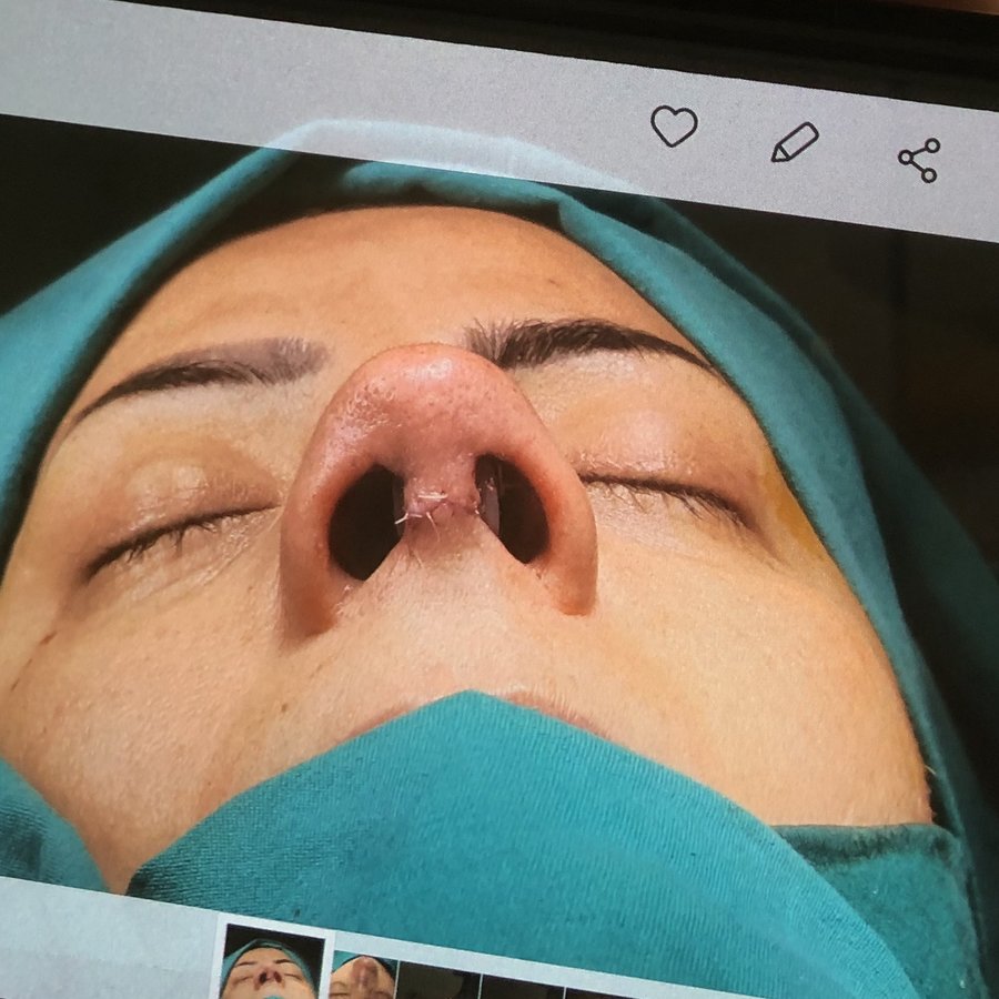 Top Clinic Turkey - Top Clinic Turkey