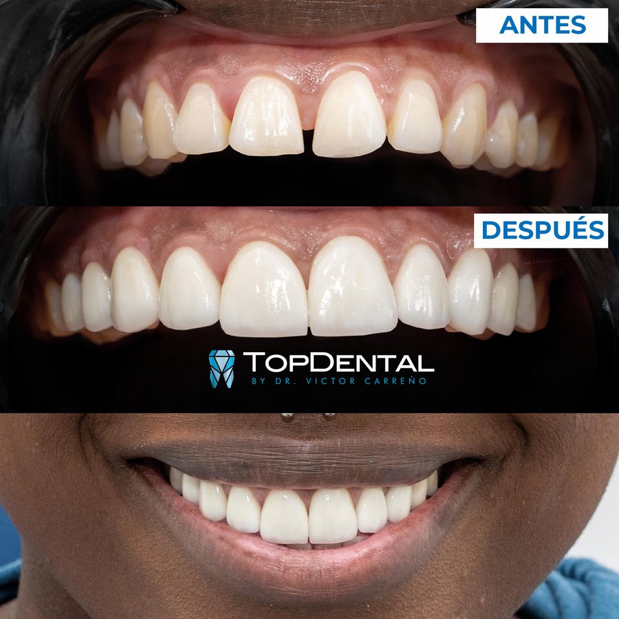 TopDental by Dr. Victor Carreno - TopDental by Dr. Victor Carreno