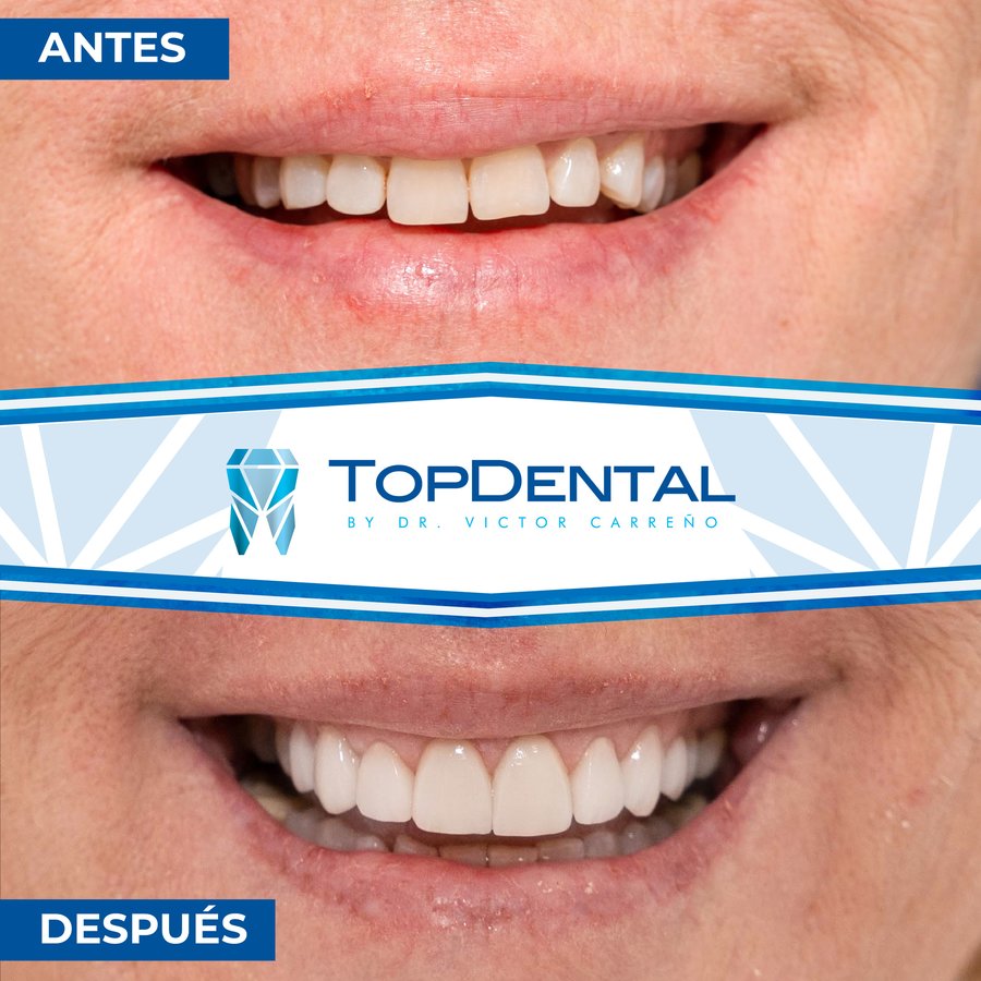 TopDental by Dr. Victor Carreno - TopDental by Dr. Victor Carreno