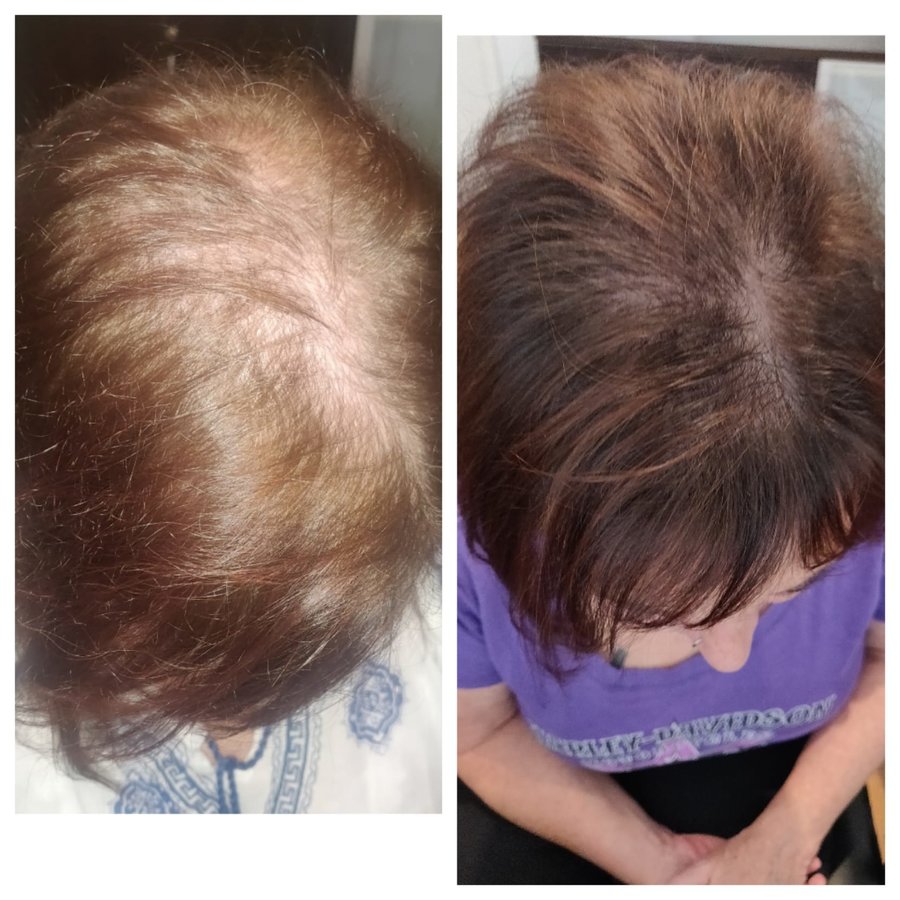 Total Hair Loss Solutions - Total Hair Loss Solutions