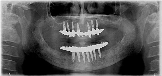 TOTALDENTAL CLINIC AND IMPLANT CENTRE - TOTALDENTAL CLINIC AND IMPLANT CENTRE