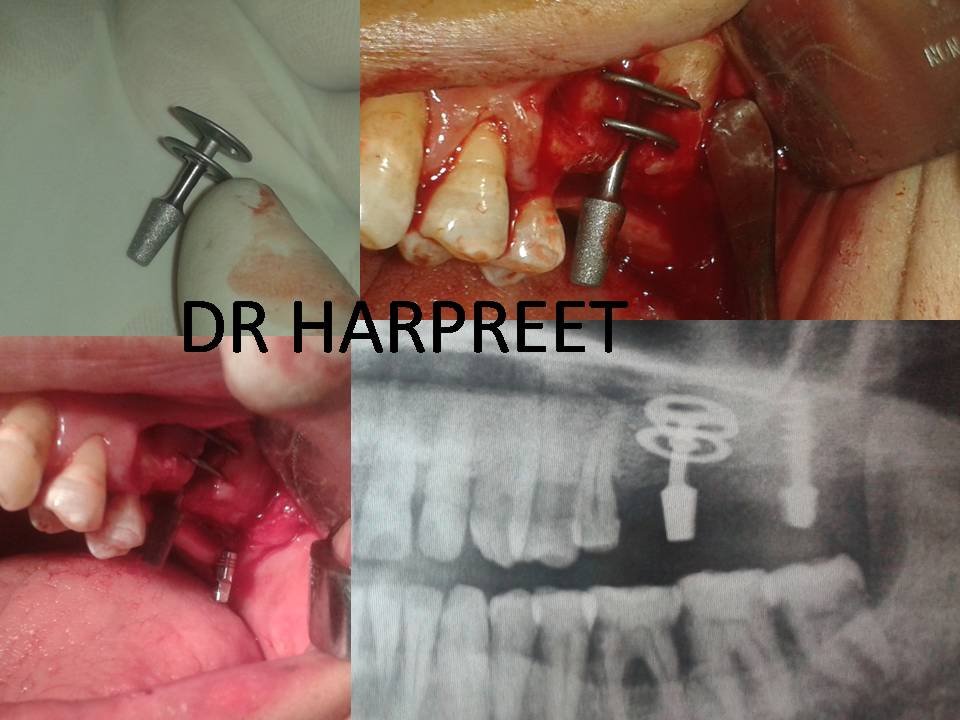 TOTALDENTAL CLINIC AND IMPLANT CENTRE - TOTALDENTAL CLINIC AND IMPLANT CENTRE