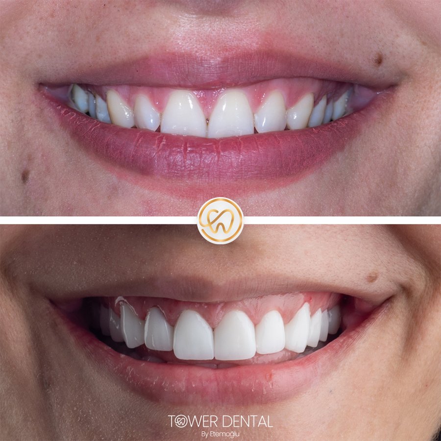 TOWER DENTAL CLINIC - TOWER DENTAL CLINIC