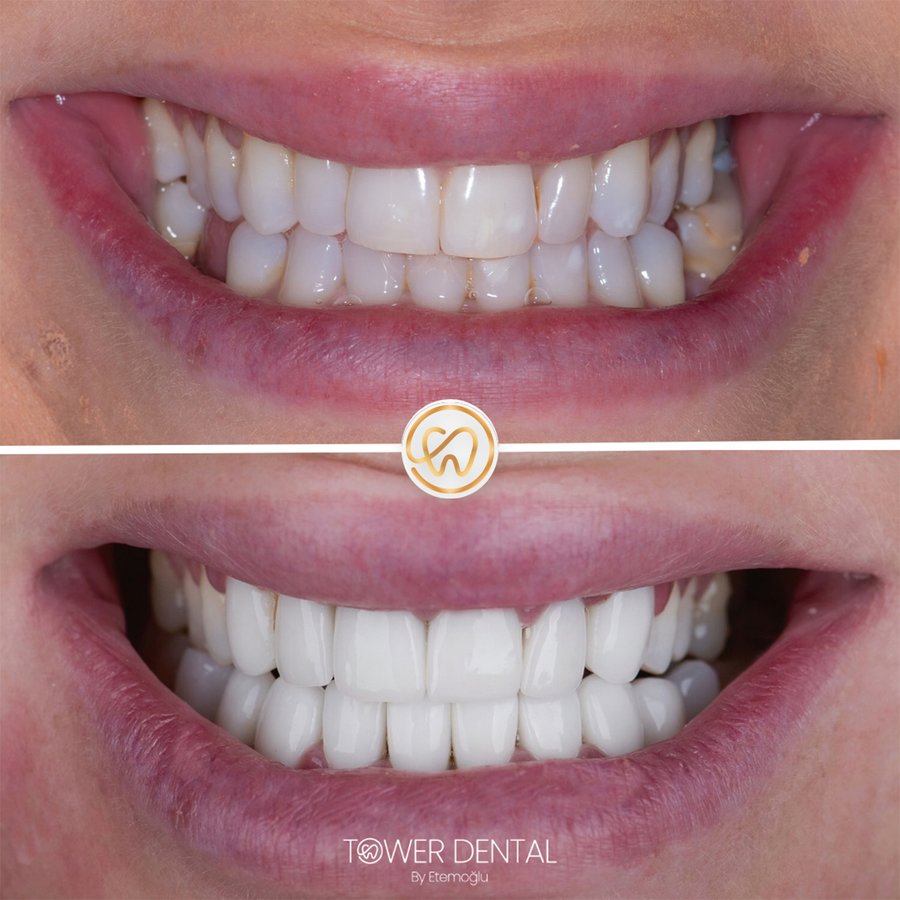 TOWER DENTAL CLINIC - TOWER DENTAL CLINIC