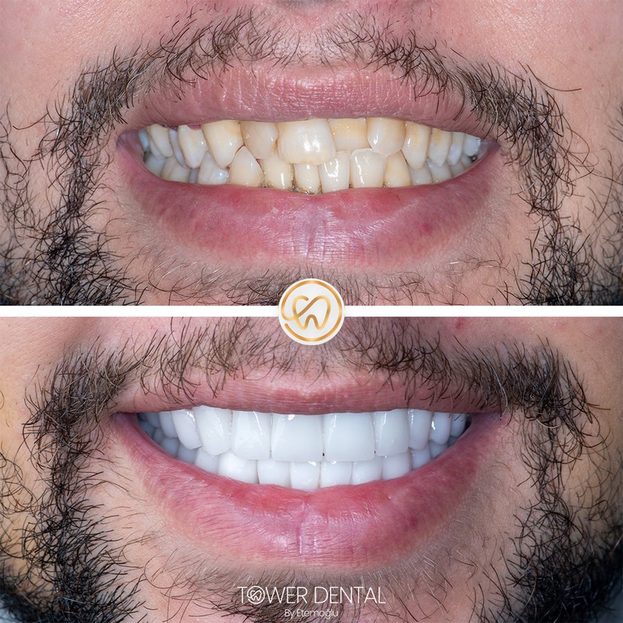 TOWER DENTAL CLINIC - TOWER DENTAL CLINIC