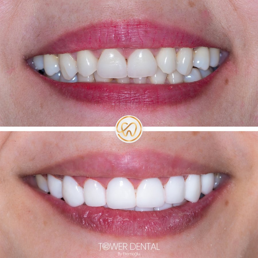 TOWER DENTAL CLINIC - TOWER DENTAL CLINIC