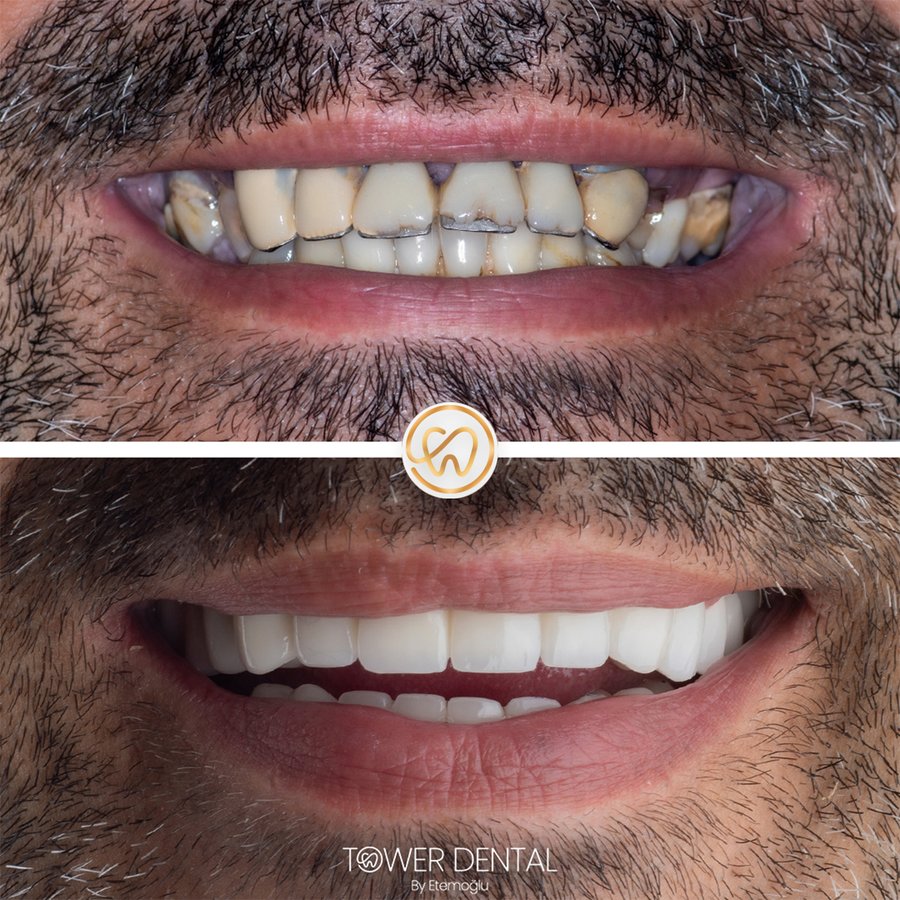 TOWER DENTAL CLINIC - TOWER DENTAL CLINIC