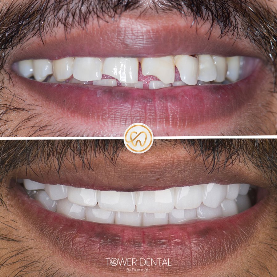 TOWER DENTAL CLINIC - TOWER DENTAL CLINIC