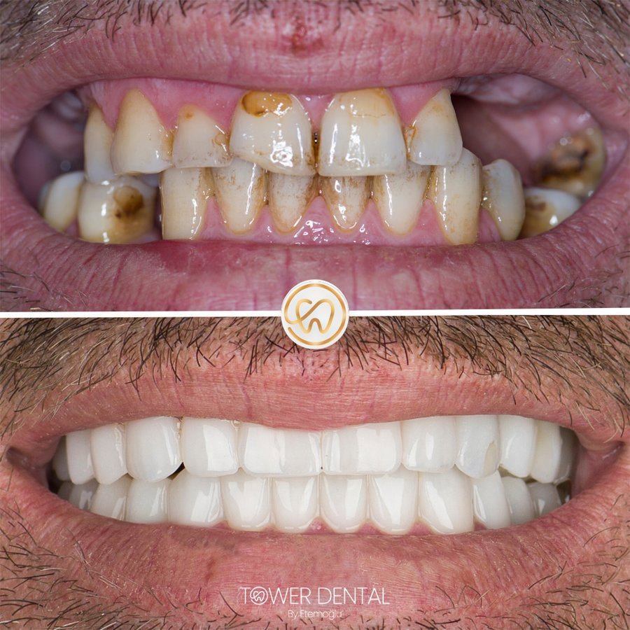 TOWER DENTAL CLINIC - TOWER DENTAL CLINIC