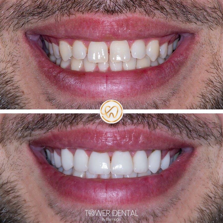 TOWER DENTAL CLINIC - TOWER DENTAL CLINIC