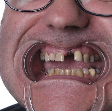 TOWER DENTAL CLINIC - TOWER DENTAL CLINIC