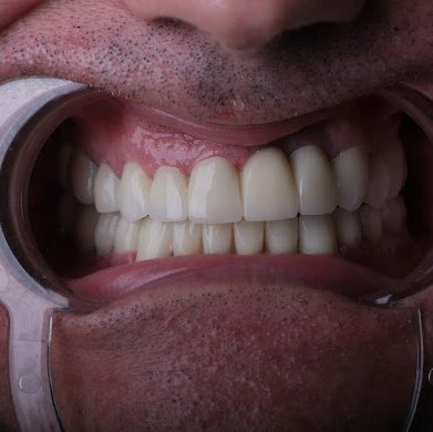 TOWER DENTAL CLINIC - TOWER DENTAL CLINIC