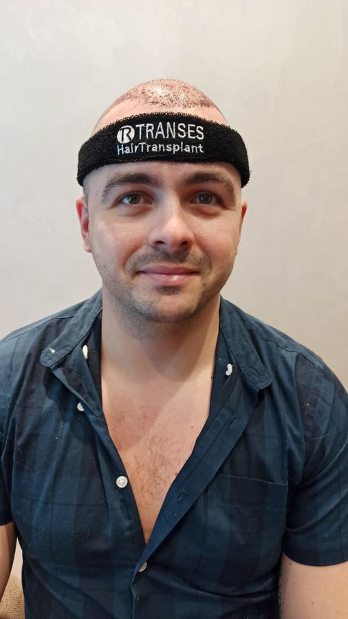 Transes Hair Transplant - Transes Hair Transplant