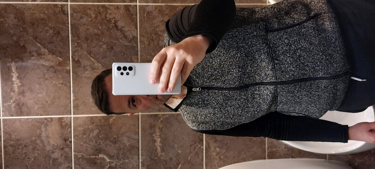 Transes Hair Transplant - Transes Hair Transplant