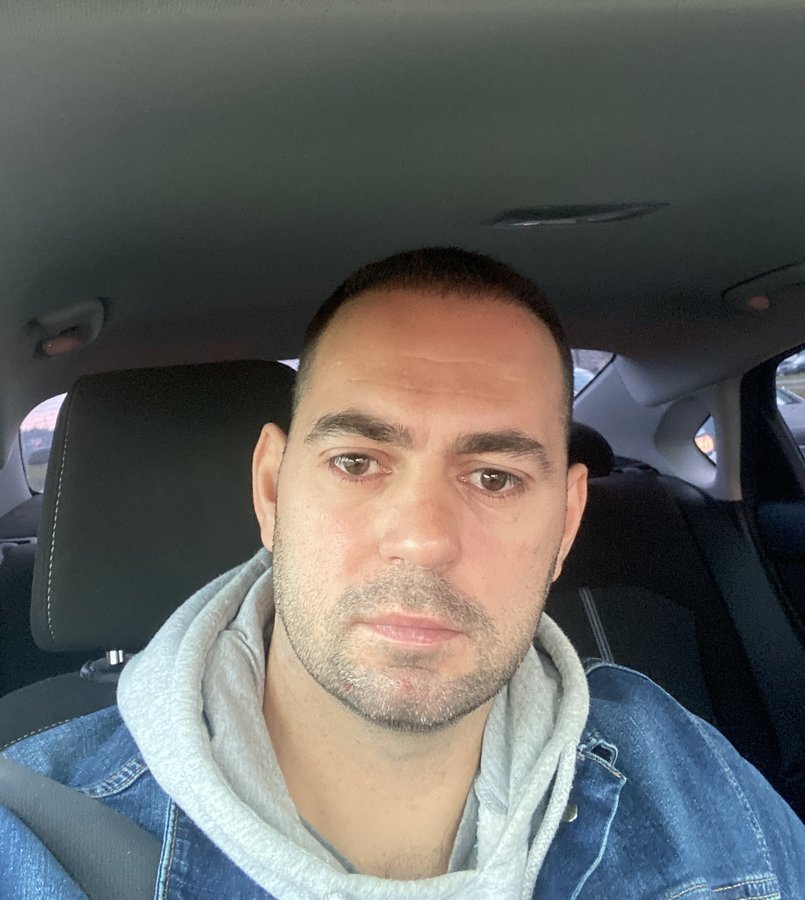 Transes Hair Transplant - Transes Hair Transplant