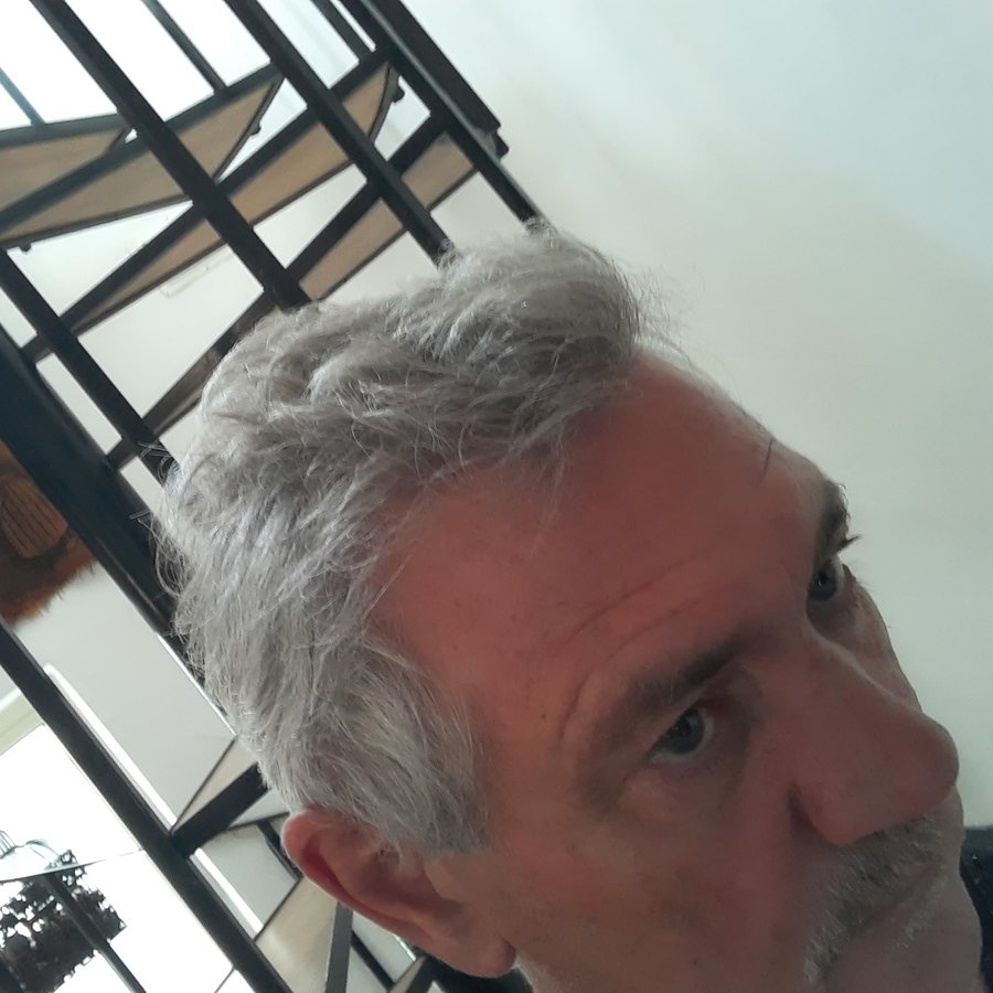 Transes Hair Transplant - Transes Hair Transplant