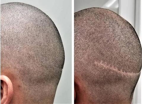 Transes SMP - Transes SMP