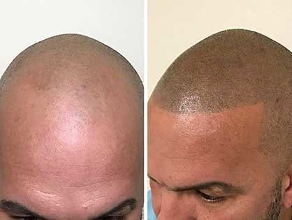 Transes SMP - Transes SMP