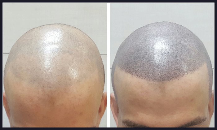 Transes SMP - Transes SMP