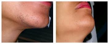 Transformation Laser & Aesthetics - Transformation Laser & Aesthetics
