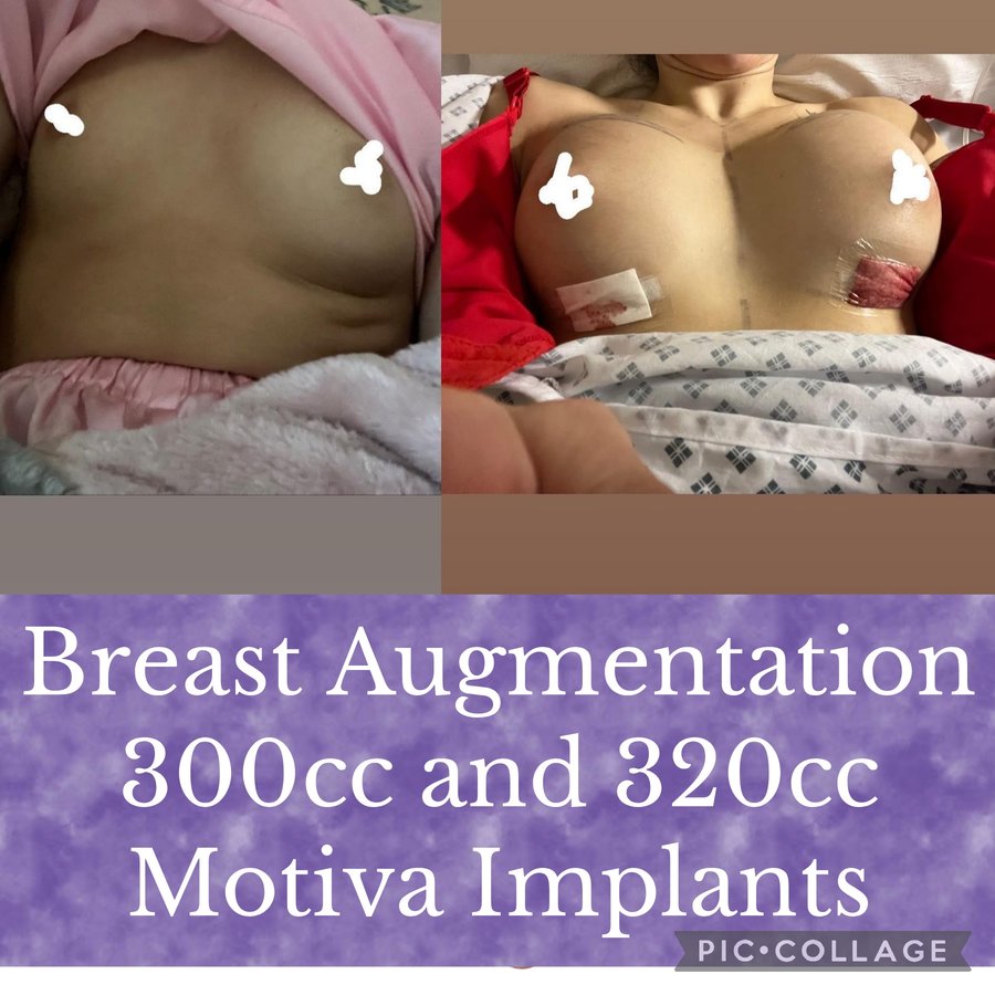 جراحة التجميل Transpire - Transpire Cosmetic Surgery