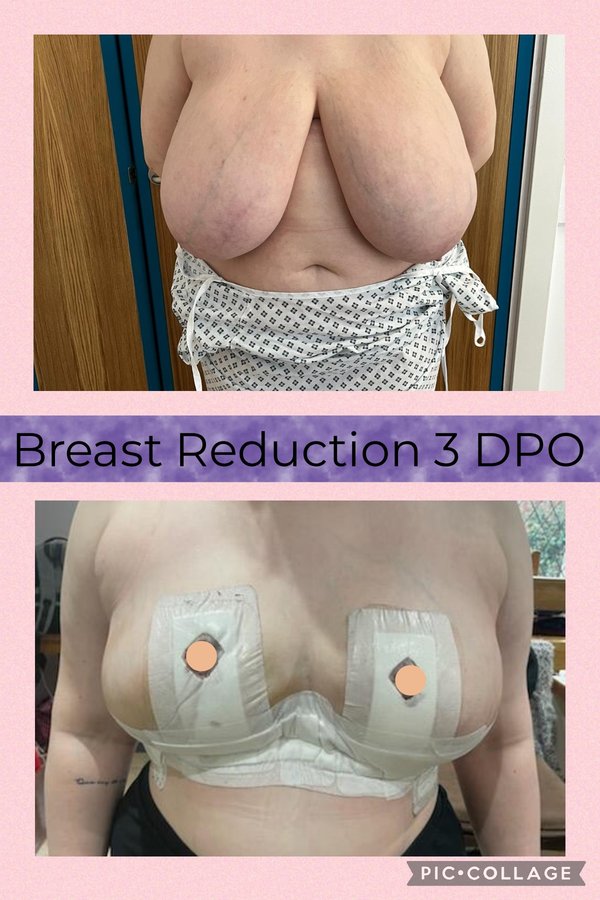 جراحة التجميل Transpire - Transpire Cosmetic Surgery