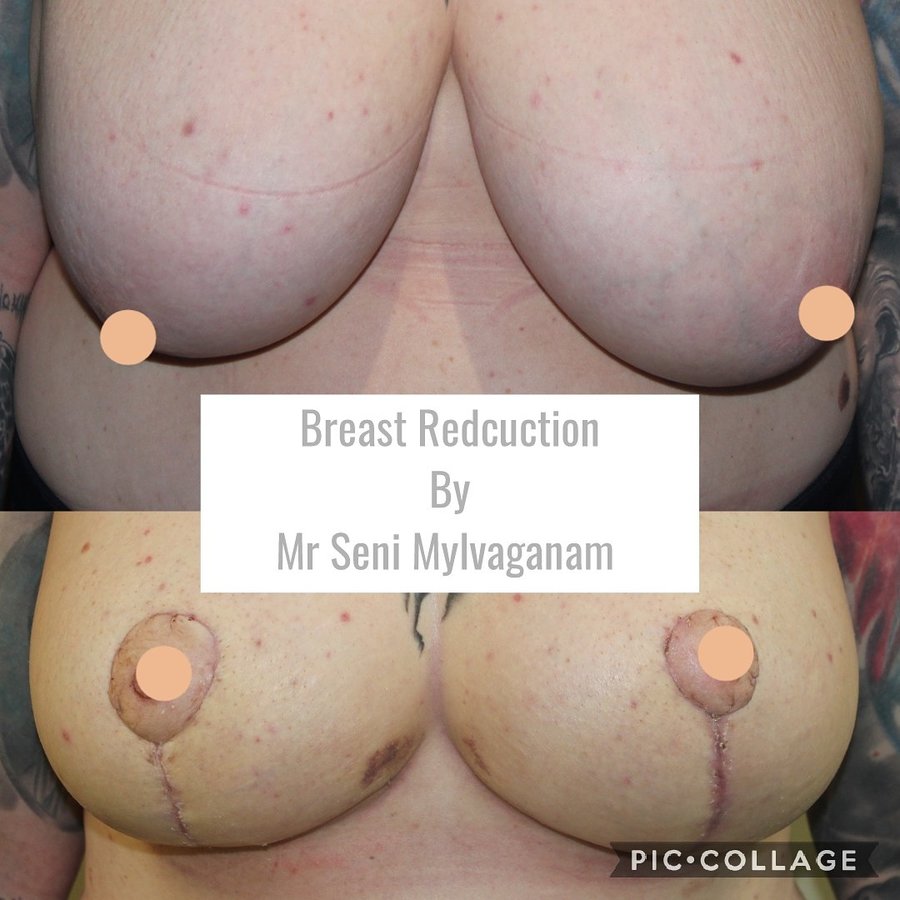 جراحة التجميل Transpire - Transpire Cosmetic Surgery