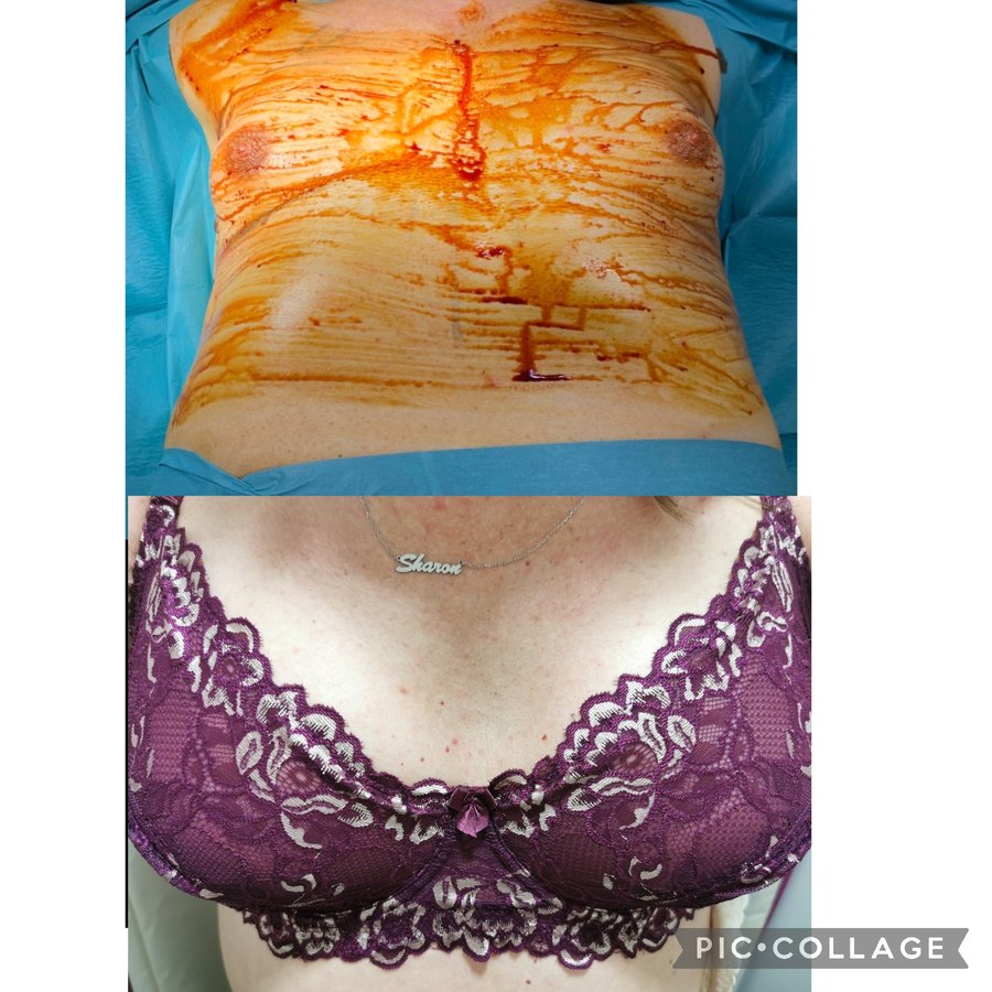 جراحة التجميل Transpire - Transpire Cosmetic Surgery