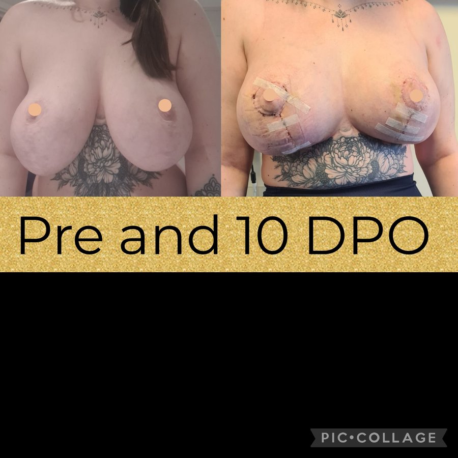 جراحة التجميل Transpire - Transpire Cosmetic Surgery