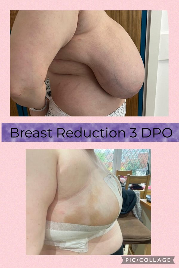 جراحة التجميل Transpire - Transpire Cosmetic Surgery