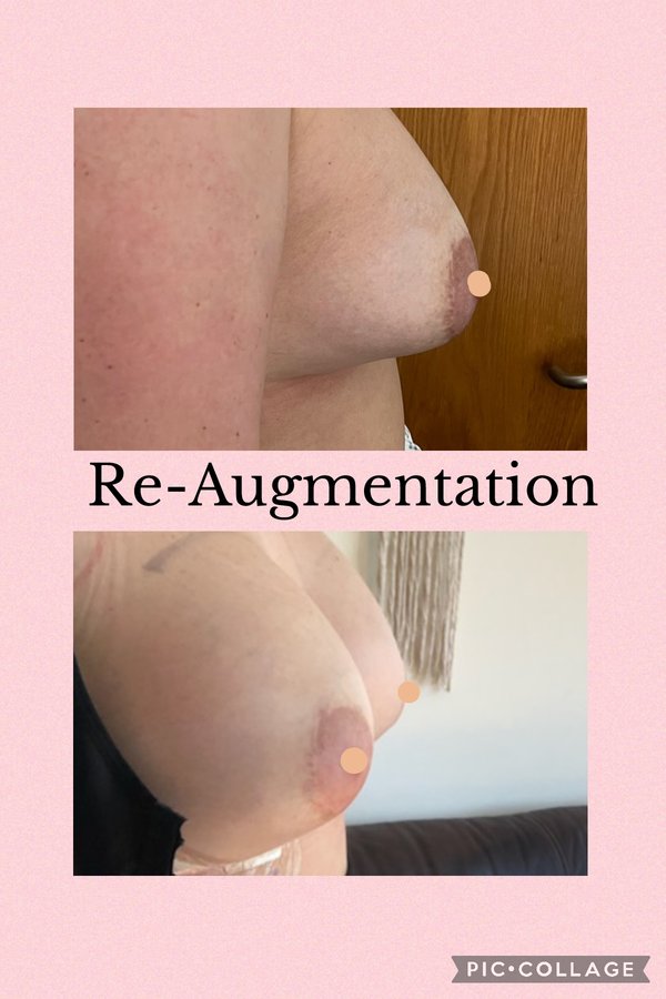 جراحة التجميل Transpire - Transpire Cosmetic Surgery