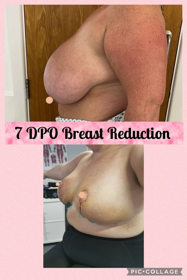 جراحة التجميل Transpire - Transpire Cosmetic Surgery