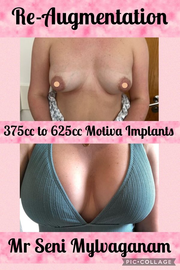 جراحة التجميل Transpire - Transpire Cosmetic Surgery