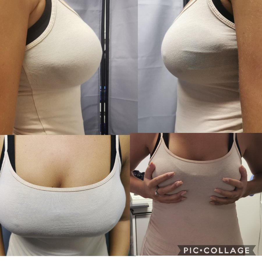 جراحة التجميل Transpire - Transpire Cosmetic Surgery