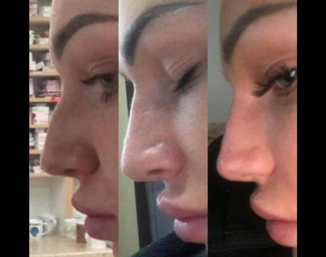 جراحة التجميل Transpire - Transpire Cosmetic Surgery