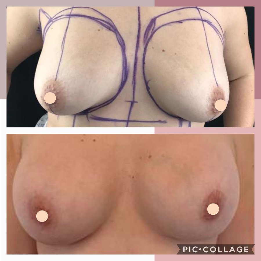 جراحة التجميل Transpire - Transpire Cosmetic Surgery