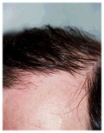 Trichology تساقط الشعر وعيادة فروة الرأس - Trichology Hair Loss and Scalp Clinic