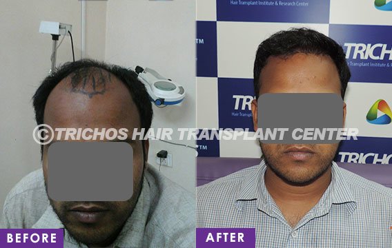 TRICHOS Hair Transplant Institute - TRICHOS Hair Transplant Institute