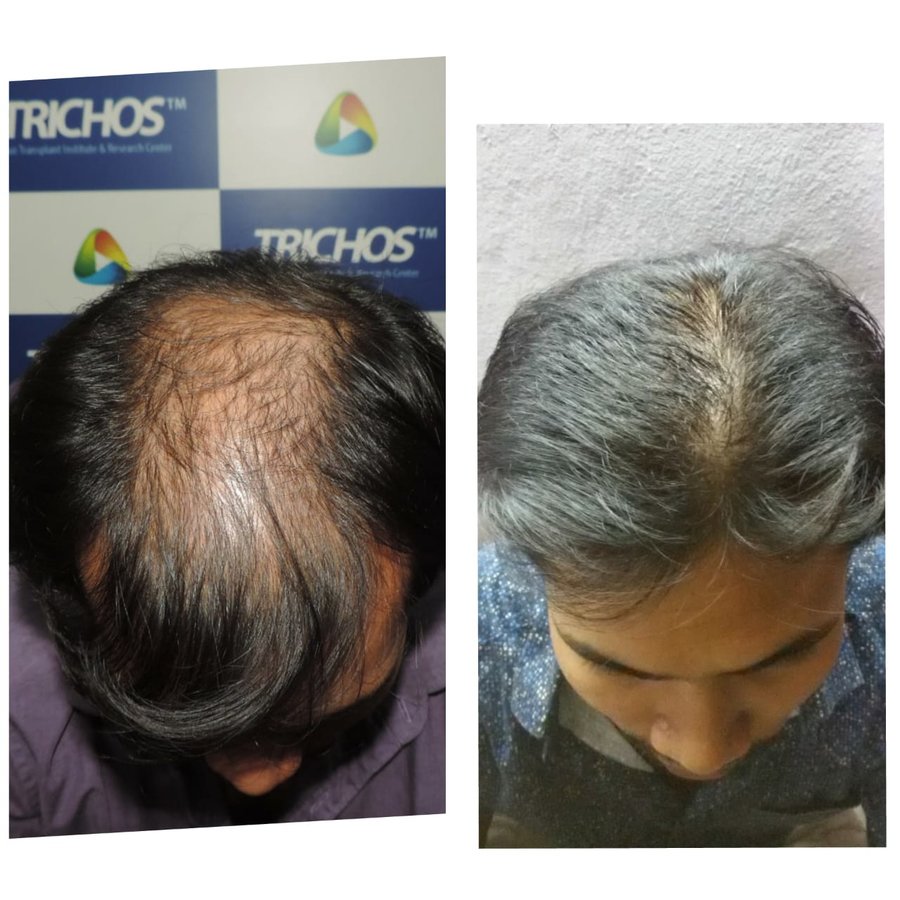TRICHOS Hair Transplant Institute - TRICHOS Hair Transplant Institute