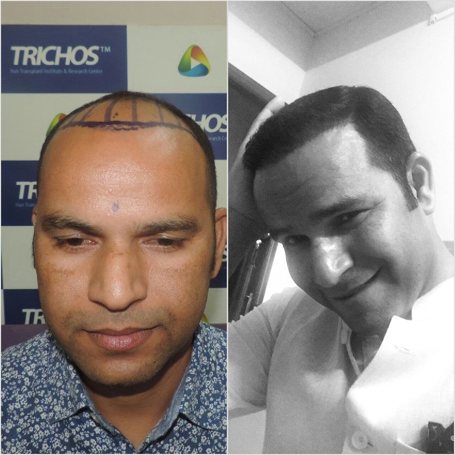 TRICHOS Hair Transplant Institute - TRICHOS Hair Transplant Institute