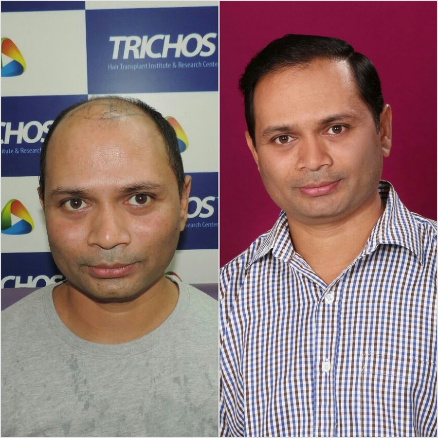 TRICHOS Hair Transplant Institute - TRICHOS Hair Transplant Institute