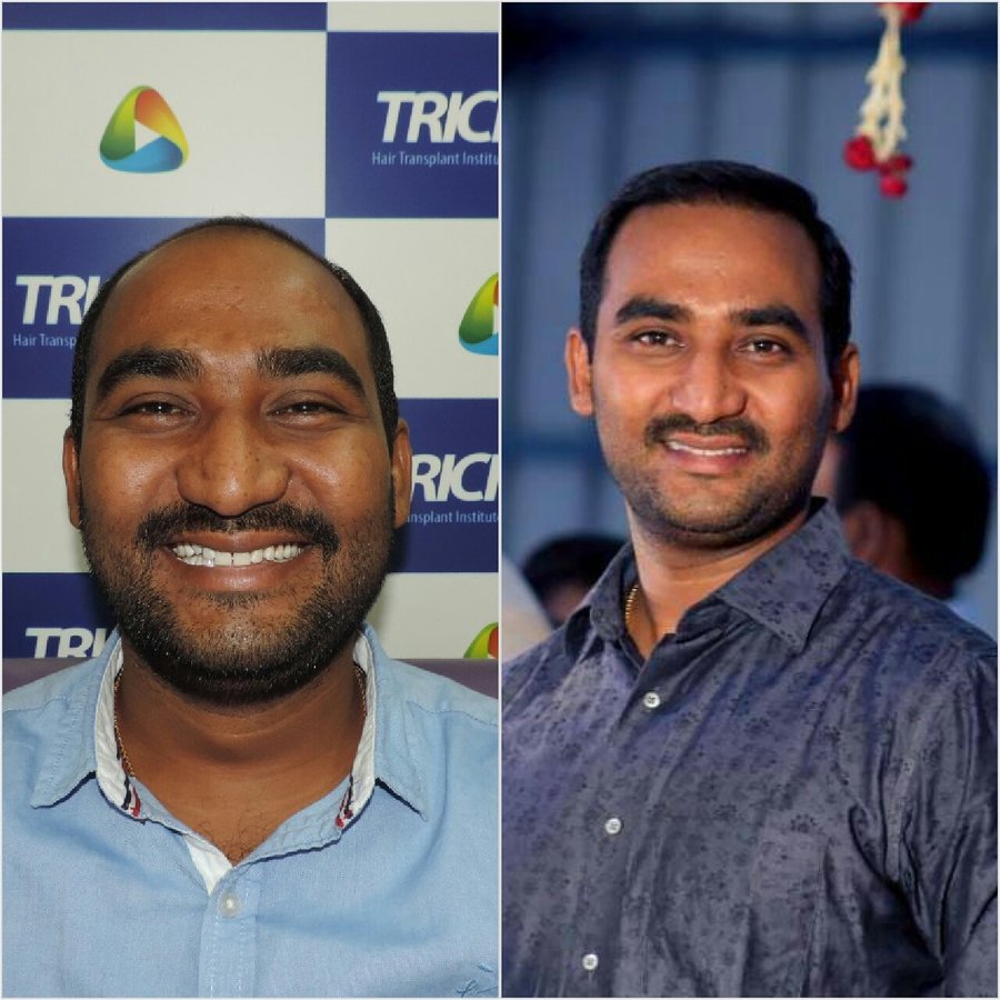 TRICHOS Hair Transplant Institute - TRICHOS Hair Transplant Institute